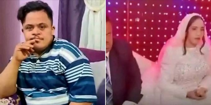  النيابة تبعد عروسة المصاب بمتلازمة داون عن زوجها 