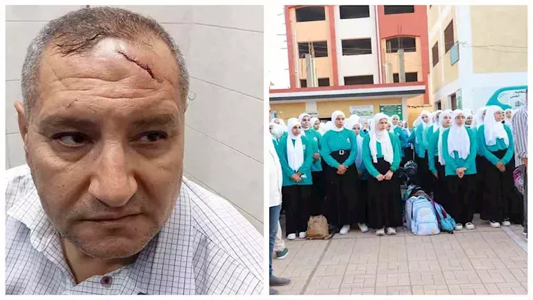 17 غرزة في رأس مدير مدرسة بالدقهلية.. ولي أمر يعتدي عليه بسبب نقل ابنه