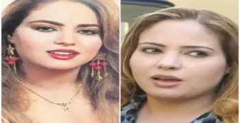 وفاء مكي قبل وبعد حقن تدوير الوجه.. قالت: «معملتش عمليات تجميل»