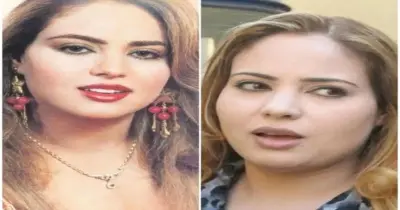 وفاء مكي قبل وبعد حقن تدوير الوجه.. قالت: «معملتش عمليات تجميل»