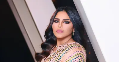 أحلام الشامسي تجري عملية جراحية لشد الوجه بتقنية السوفت ويف