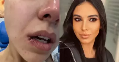 صورة سلمى أبو ضيف بعد حرق وجهها وقطع فمها
