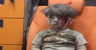 الطفل عمران السوري يظهر من جديد.. هذه المرة مع شقيقته