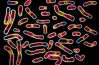 ما القاعدة التي توجد في rna ولاتوجد في dna؟