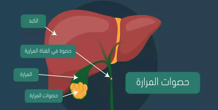  أعراض المرارة.. فجأة هتلاقي نفسك بتقول الحقوني 