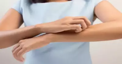 أغرب 6 أنواع للحساسية.. وكيفية التعامل معها