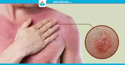 احمي نفسك من سرطان الجلد.. طرق الوقاية من المرض
