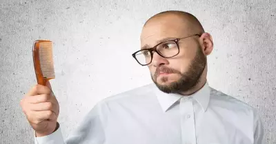 الحق نفسك من الصلع.. هي دي الأسباب وطريقة العلاج