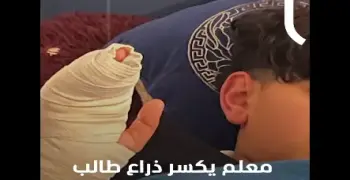 الاعتداء على طالب في مدرسة دولية في مصر أدى لكسر يده