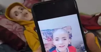 يزن الكفارنة.. صور مفزعة لطفل من غزة مات جوعا