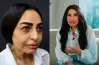 سلوى خطاب تكشف تفاصيل خضوعها لعملية تجميل في وجهها