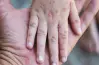 موعد انطلاق الحملة القومية للتطعيم ضدة الحصبة بالجيزة 2026
