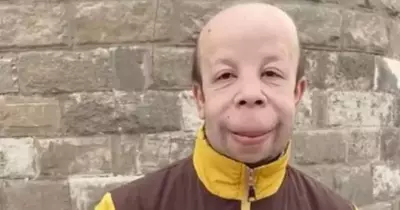 قصة حسام بوجي مع التنمر بسبب ملامحه