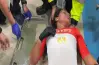 إصابة ابتسام زايد بطلة منتخب الدراجات في بطولة العالم (فيديو)