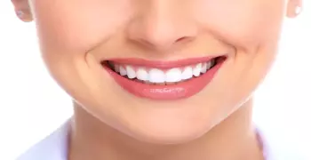 معلومات مهمة عن ابتسامة هوليود