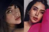 هيا مرعشلي قبل التجميل.. جميع إجراءاتها التجميلية بعد لفتها الانتباه مع أنس بوخش