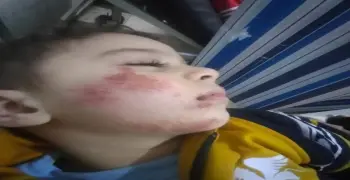 لحظة سقوط طفل بإحدى قرى المنصورة.. فيديو صادم