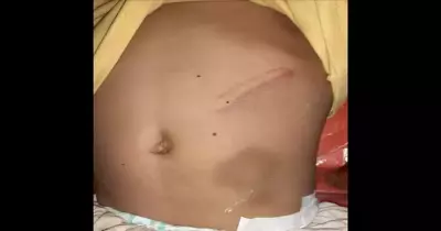 إخلاء سبيل المتهمة بتعذيب ابنة زوجها في القليوبية