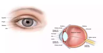أعراض ضمور العصب البصري وعلاجه في ألمانيا