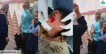 سيدة تستعين بكلب لمهاجمة طفل بمدرسة في مصر الجديدة (صور)