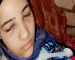 فرحة رضا.. قصة العائدة من الموت في المنوفية