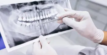 طريقة التقديم على مسابقة التميز العلمي لطب الأسنان بوزارة الصحة 2026.. اعرف كيف