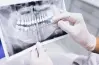 طريقة التقديم على مسابقة التميز العلمي لطب الأسنان بوزارة الصحة 2026.. اعرف كيف