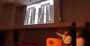 أستاذ بجامعة الأزهر يبتكر طريقة لعلاج تشوهات العظام