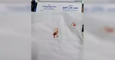 تدخل طبي لاستخراج سماعة من أذن طالب بالثانوية العامة في الدقهلية.. حاول الغش بها