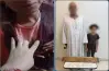 القبض على أب لتعديه على طفلته بعد إصابتها بجرح في الرأس.. تفاصيل