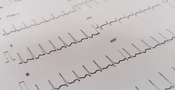 الحل الصحيح.. يسمى الأثر الناتج عن تراكب نبضتين أو أكثر بالتداخل