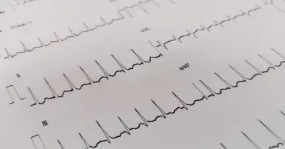 الحل الصحيح.. يسمى الأثر الناتج عن تراكب نبضتين أو أكثر بالتداخل