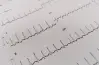 الحل الصحيح.. يسمى الأثر الناتج عن تراكب نبضتين أو أكثر بالتداخل