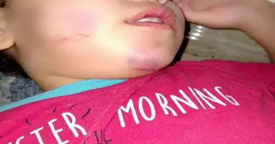 صور صادمة لتعذيب طفل بالضرب داخل حضانة بالهرم