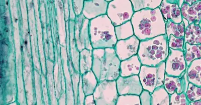 الخلايا البرنشيمية parenchyma cells خلايا رقيقة الجدران.. صواب أم خطأ؟