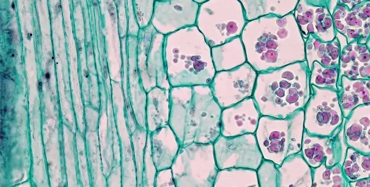  الخلايا البرنشيمية parenchyma cells خلايا رقيقة الجدران.. صواب أم خطأ؟ 