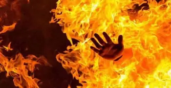 القبض على ربة منزل لإشعال النار في نفسها لجذب تعاطف المتابعين.. وناشرة الفيديو تربح من المشاهدات