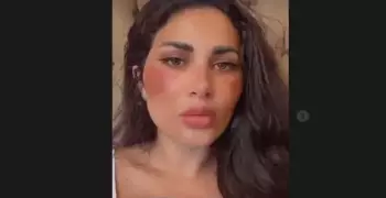 قصة فيديو ظهور طليقة أحمد الفيشاوي بحروق مفزعة