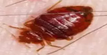 الطاعون الدبلي وباء صيني جديد يهدد العالم تنقله البراغيث