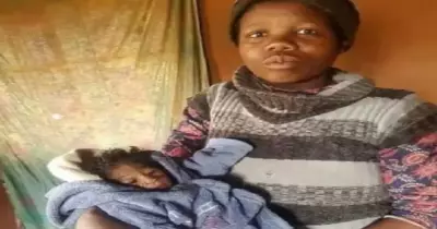 قصة رضيعة مصابة بالشيخوخة المبكرة وتقع تحت أنياب التنمر.. صور