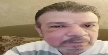 ما هو مرض أحمد سلامة الذي تسبب في تغير ملامح وجهه بالصور