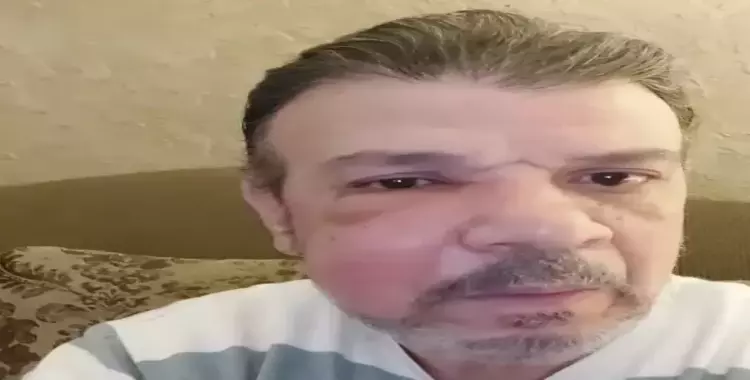  ما هو مرض أحمد سلامة الذي تسبب في تغير ملامح وجهه بالصور 