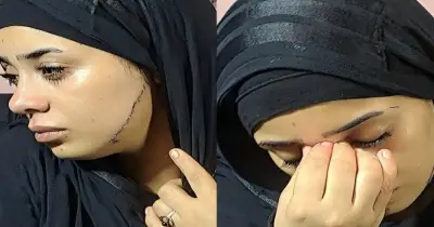 41 غرزة بوجه عروس مصر القديمة بسبب الغيرة.. فرحة ما تمت