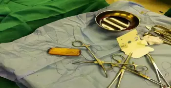 في معدته منذ 6 أشهر.. استخراج محمول من مريض بأسوان