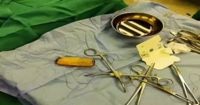 في معدته منذ 6 أشهر.. استخراج محمول من مريض بأسوان
