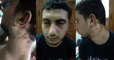 أمن جامعة طنطا يعتدي على طالب بالضرب (صور)