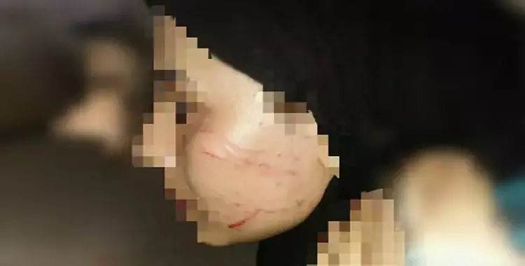  اتهامات لأمن مدينة بنات الأزهر بالاعتداء على طالبة بكلية الطب 
