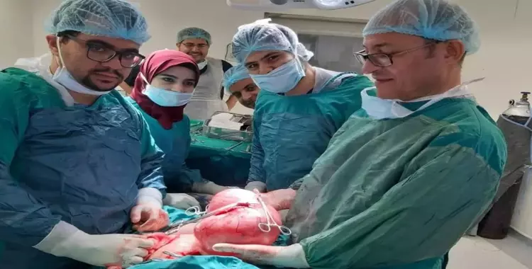  استئصال ورم وزنه 3 كيلو ونصف من مريضة في مستشفى جامعة كفر الشيخ (صور) 