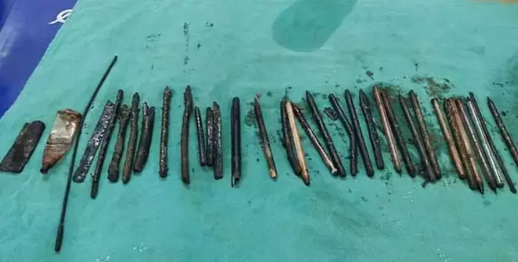  استخراج 33 قطعة معدنية من بطن رجل هندي بينها شفرات حلاقة وسكين (صور) 