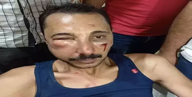  محامي المحلة أحمد رمزي بعد اعتداء ضابط شرطة عليه 
